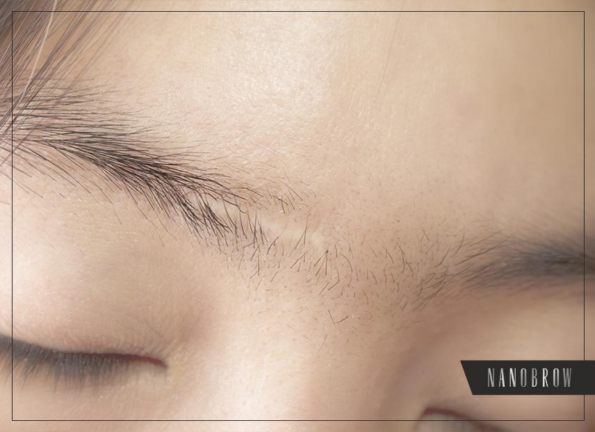 مكياج تغطية الندوب 